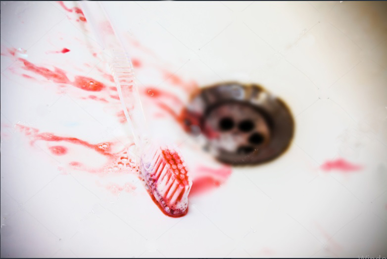 Diş ve Dişeti Rahatsızlıkları için Probiyotik Gargaraların Faydası var mıdır? 