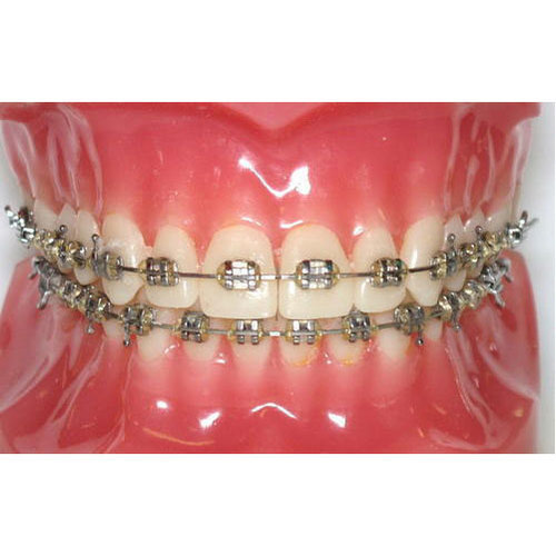 Ortodontik Apareyler ve Probiyotik Gargara Kullanımı